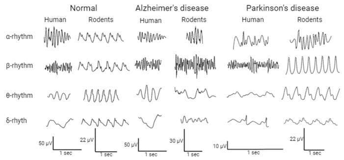 A comparative diagnostic chart displaying Electroencephalogram (EEG) waveforms across four frequency bands: alpha (α), beta (β), theta (θ), and delta (δ) rhythms. The grid compares brain activity in three cohorts: Normal subjects, Alzheimer's disease models, and Parkinson's disease models, with side-by-side sub-columns for humans and rodents. Key visual findings include the slowing and irregular shape of the human alpha rhythm in Alzheimer's disease compared to the rhythmic normal state. In Parkinson's disease, the human beta rhythm demonstrates increased variability and high-frequency oscillations, while the rodent beta rhythm shows a distinct, high-amplitude, repetitive sinusoidal-like pattern. Voltage and time scales (e.g., 50 μV per 1 sec) are provided for each human and animal model, highlighting differences in signal amplitude. This educational illustration demonstrates the translation of neurophysiological biomarkers between human clinical cases and animal research models in neurology and psychiatry.