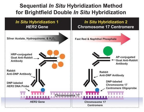 This medical diagram illustrates the molecular mechanism of a sequential Brightfield Double In Situ Hybridization (BDISH) method for detecting HER2 gene amplification and Chromosome 17 centromere (CEN17) status. The process is divided into two phases. Phase 1 (left) details HER2 gene detection: a DNP-labeled HER2 DNA probe hybridizes to the target gene, followed by binding of a Rabbit Anti-DNP primary antibody. A secondary HRP-conjugated Goat Anti-Rabbit antibody then facilitates a silver precipitation reaction (using silver acetate, hydroquinone, and H2O2), resulting in a black/grey signal. Phase 2 (right) depicts CEN17 detection on the same chromosome: a DNP-labeled CEN17 oligoprobe hybridizes to the centromere, followed by the same Rabbit Anti-DNP primary antibody. A different secondary antibody, AP-conjugated Goat Anti-Rabbit, is applied to catalyze a Fast Red and Naphthol Phosphate reaction, producing a red/pink signal. This dual-color sequential technique allows for simultaneous visual assessment of gene-to-chromosome ratios under a standard brightfield microscope, which is critical for breast cancer diagnostics and HER2 status determination.