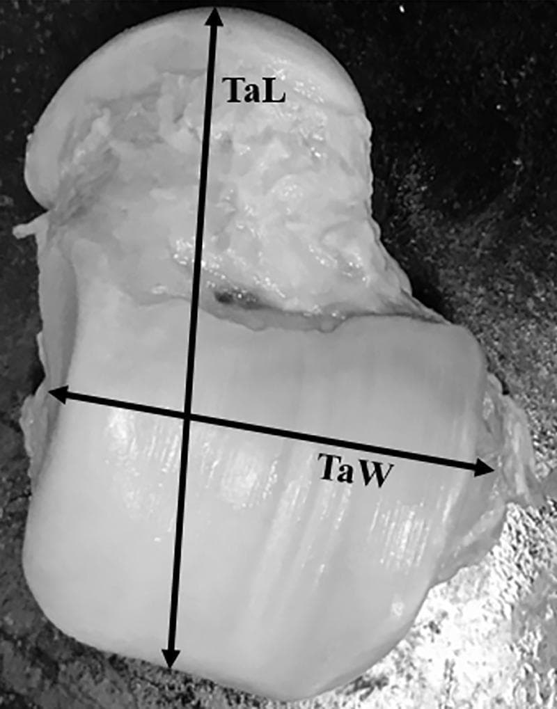A clinical photograph of an isolated human talus bone specimen, showing the superior aspect. The bone surface appears smooth with preserved articular cartilage across the trochlea and neck regions. Two primary morphometric measurements are superimposed on the image with black double-headed arrows: Talar Length (TaL), extending vertically along the longitudinal axis from the most anterior point of the talar head to the posterior aspect; and Talar Body Width (TaW), extending horizontally across the widest mediolateral dimension of the talar body. This visual serves as an anatomical reference for orthopedic morphometry and surgical planning for ankle arthroplasty or reconstruction. The specimen is presented in a neutral, educational context, highlighting key landmarks used in cadaveric anatomical studies.