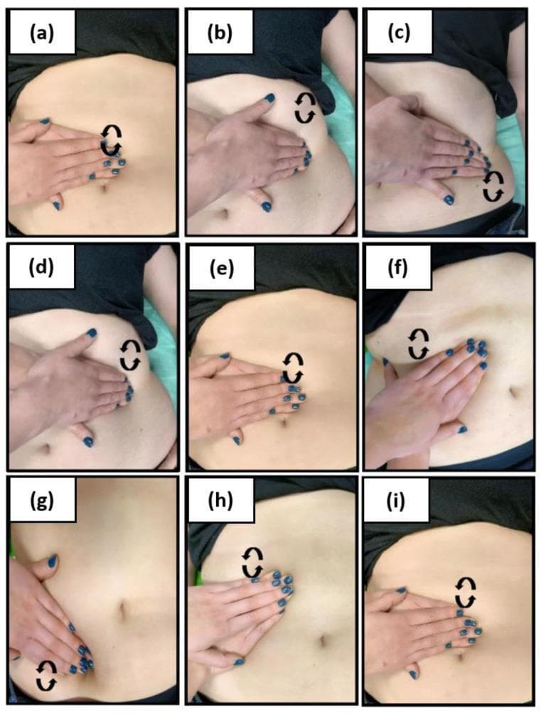 A series of nine clinical photographs (a-i) illustrating manual lymphatic drainage (MLD) techniques for the abdominal region, specifically showing deep drainage protocols. The images demonstrate precise hand placements and orientations relative to key anatomical landmarks on a patient in the supine position. Key positions include central placement over the umbilicus (naval), positioning parallel to the left and right costal arches, and alignment with the left and right inguinal ligaments. Each sub-image includes black circular arrow icons indicating the intended direction of circular manual pressure and rhythmic manipulation required for the effleurage technique. This visual guide demonstrates the sequential steps used in physical therapy to facilitate lymphatic flow and reduce lymphostasis in patients with conditions such as obesity or lymphedema. The series serves as an educational resource for medical and physiotherapy professionals to visualize the correct hand ergonomics and directional strokes necessary for effective abdominal lymphatic drainage.