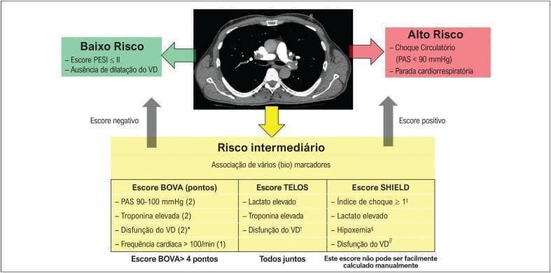 A medical infographic and diagnostic algorithm in Portuguese for risk stratification of acute pulmonary embolism (APE). At the center is a diagnostic image: a transverse/axial CT pulmonary angiogram (CTPA) showing the mediastinum and major hilar vessels, including the pulmonary artery and heart chambers. The algorithm branches into three risk categories: 'Baixo Risco' (Low Risk), defined by a PESI score ≤ II and absence of right ventricular (RV) dilation; 'Alto Risco' (High Risk), characterized by circulatory shock (SBP < 90 mmHg) or cardiorespiratory arrest; and 'Risco intermediário' (Intermediate Risk). The intermediate section details an association of biomarkers across three scoring systems: the BOVA score (incorporating SBP, troponin, RV dysfunction, and heart rate), the TELOS score (lactate, troponin, and RV dysfunction), and the SHIELD score (shock index, lactate, hypoxemia, and RV dysfunction). Arrows indicate the clinical flow based on positive or negative scores, integrating clinical vitals, imaging findings of RV strain, and laboratory markers for triage and management.