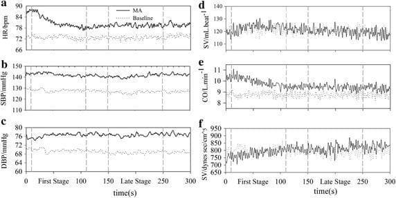 This physiological data visualization consists of six line graphs (labeled a-f) illustrating time-variant cardiovascular and hemodynamic responses during a mental arithmetic (MA) task compared to a baseline. The X-axis represents time in seconds (0-300s), divided into a 'First Stage' and a 'Late Stage'. The indexes monitored include: (a) Heart Rate (HR/bpm), (b) Systolic Blood Pressure (SBP/mmHg), (c) Diastolic Blood Pressure (DBP/mmHg), (d) Stroke Volume (SV/mL.beat⁻¹), (e) Cardiac Output (CO/L.min⁻¹), and (f) Systemic Vascular Resistance (SVR/dynes sec/cm⁵). The solid line represents the MA task, while the dotted line represents the baseline. In graphs a, b, c, and e, the MA task shows an immediate and sustained elevation compared to the baseline, characterized by an initial peak followed by a slight decrease toward a stable yet elevated plateau. Graphs d and f show higher variability and overlap between the task and baseline conditions. This chart is used to demonstrate the autonomic nervous system's dynamic reaction to mental stress, specifically illustrating acute tachycardia and increased blood pressure mediated by parasympathetic withdrawal and sympathetic modulation.