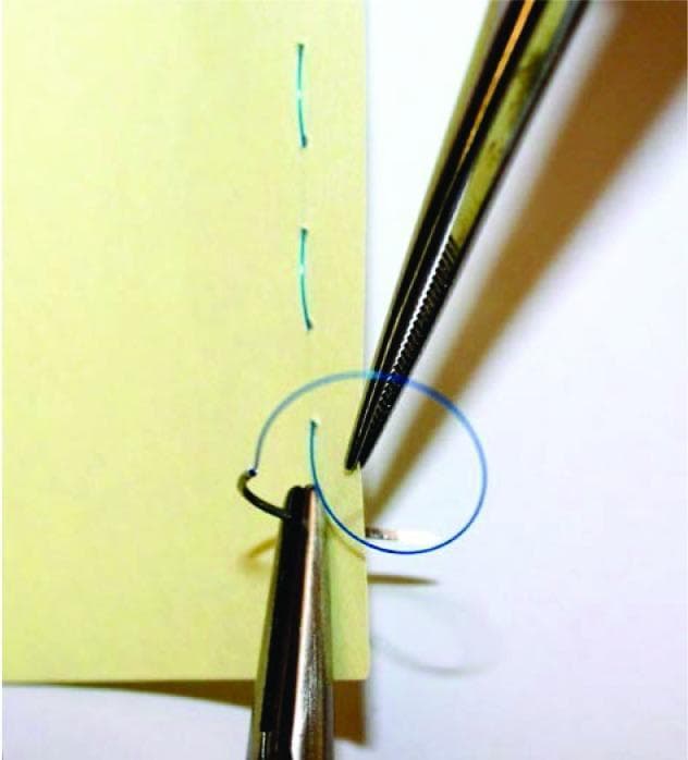 This clinical educational photograph demonstrates basic surgical suturing techniques using a simulated model. The image depicts a yellow synthetic material serving as a tissue analog, showing two parallel lines of previously placed green interrupted sutures. Two primary surgical instruments are visible: a needle holder (hemostat) and a pair of serrated tissue forceps (Adson or similar). The needle holder is shown grasping a curved surgical needle which has passed through the material, trailing a blue monofilament suture. The tissue forceps are positioned to stabilize the edge of the material and manipulate the suture loop to facilitate knot tying. This visual is designed for medical training to illustrate hand-instrument coordination, suture placement, and the mechanics of instrument-assisted knot tying in a controlled, non-biological environment. It serves as a foundational resource for teaching surgical skills and wound closure principles to medical students and surgical residents.