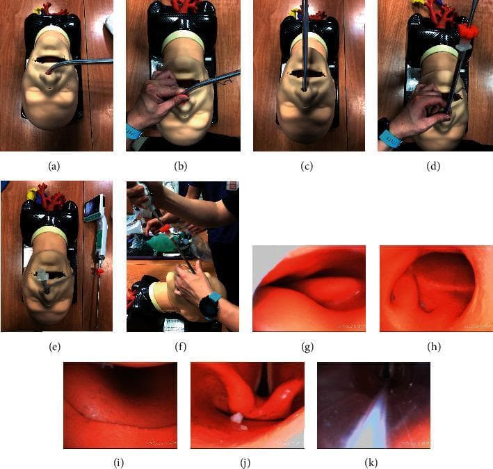 This composite educational image illustrates the multi-step process of nasotracheal intubation using a Trachway video stylet, demonstrated on a medical mannequin. Panels (a) through (f) provide a superior view of the external clinical technique, showing the insertion of the endotracheal tube (ETT) into the nostril, followed by a 90-degree rotation and elevation to the midline to align the stylet with the anatomical curve of the nasopharynx. Panels (g) through (k) display the concurrent internal endoscopic views captured by the stylet's camera. These internal frames demonstrate the advancement through the nasopharynx (g, h), the transition into the oropharynx (i), and the direct visualization of the laryngopharynx and glottic opening (j). The final frame (k) confirms successful placement as the ETT tip passes through the vocal cords into the trachea. This content demonstrates difficult airway management techniques, highlighting the use of video-assisted stylets to facilitate visualization without requiring significant head or neck manipulation, which is essential in patients with limited mouth opening or cervical spine precautions.
