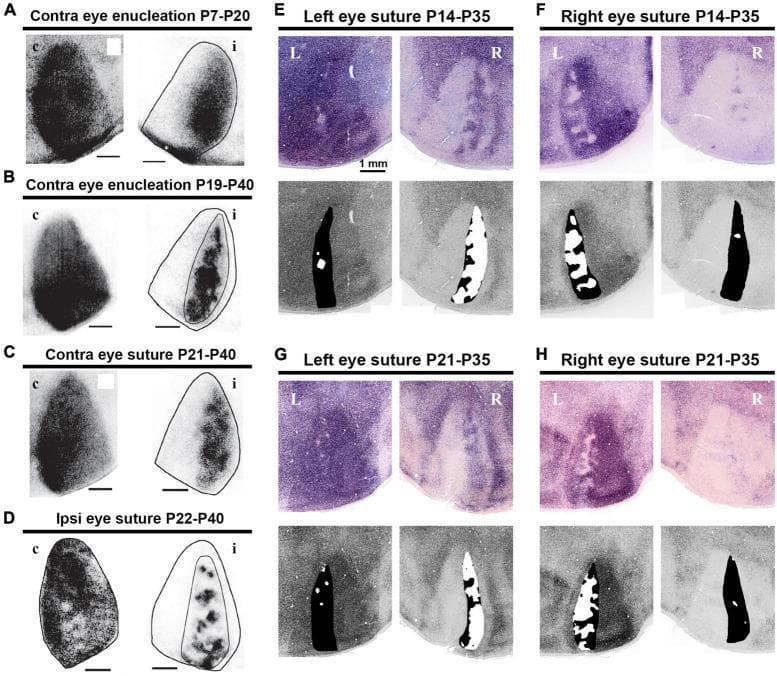 This composite figure displays microscopy images and corresponding activity maps illustrating ocular dominance columns (ODCs) in the rat primary visual cortex (V1) under various experimental conditions. Panels A–D utilize wheat germ agglutinin-conjugated horseradish peroxidase (WGA-HRP) transneuronal tracing to visualize anatomical ODC patterns in the contralateral (c) and ipsilateral (i) hemispheres. Conditions include monocular enucleation (A, B) and eyelid suture (C, D) performed during different postnatal (P) developmental windows. These images demonstrate how deprivation shifts the territories and density of labeling in favor of the active eye, revealing patchy segregation in the binocular zone. Panels E–H show physiological ODC patterns through immediate-early gene (IEG) expression in the left (L) and right (R) hemispheres following monocular suture at P14-P35 (E, F) and P21-P35 (G, H). Higher IEG expression, indicated by darker staining, correlates with increased neuronal activity in the hemisphere receiving input from the open eye. This comparison highlights ocular dominance plasticity and the differential maturation rates between anatomical connectivity and functional neuronal responsiveness during the critical period of visual development.