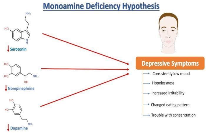 A pathophysiology diagram illustrating the 'Monoamine Deficiency Hypothesis' of depression. On the left, the chemical structures of three key monoamine neurotransmitters are shown: Serotonin (5-HT), Norepinephrine (NE), and Dopamine (DA). Each neurotransmitter is accompanied by a downward-pointing red arrow, indicating quantitative deficiency or reduced levels in the synaptic cleft or extracellular fluid. Red directional arrows point from these molecules toward a central clinical outcome box labeled 'Depressive Symptoms.' To the right, an illustration of a human face with a somber expression is paired with a bulleted list of common clinical manifestations, including consistently low mood, hopelessness, increased irritability, changed eating patterns, and trouble with concentration. The diagram effectively maps the biochemical theory of monoamine dysregulation to the neuropsychiatric presentation of Major Depressive Disorder (MDD), serving as an educational summary of the biological basis for antidepressant pharmacotherapy targeting monoamine reuptake or degradation.