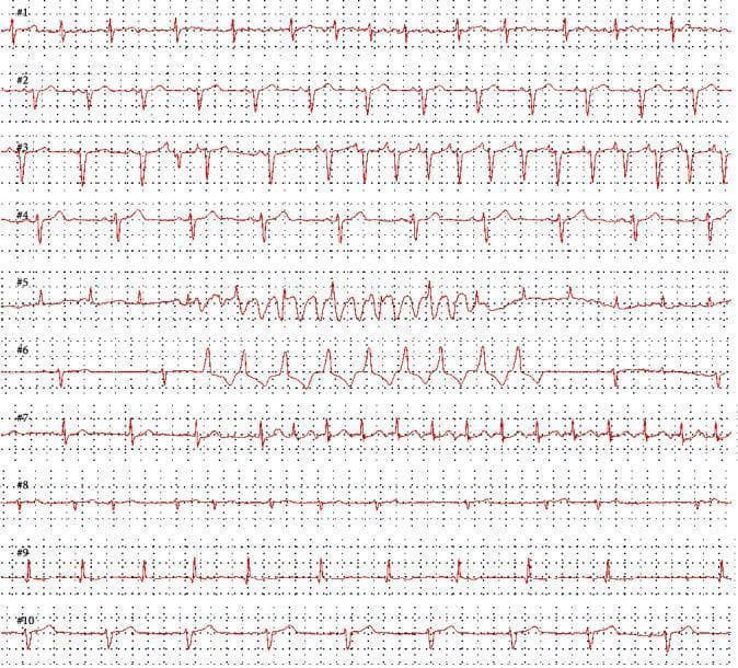 Hugging Face pmc clinical VQA raw