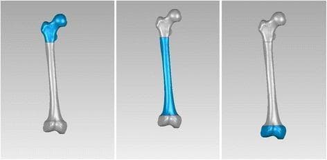 Anatomical diagram consisting of three three-dimensional digital femoral models illustrating the segmentation of the femur for biomechanical or orthopedic analysis. The models are shown in a posterior view, each highlighting a specific anatomical region in blue. The first model (left) highlights the proximal end, including the femoral head, neck, and the greater and lesser trochanteric regions. The second model (center) highlights the diaphysis (shaft), showing the long, slightly curved cortical bone section between the trochanters and the supracondylar flare. The third model (right) highlights the distal end, comprising the medial and lateral condyles and the intercondylar notch. These computer-generated models facilitate the study of intramedullary nail insertion paths, curvature radius, and anatomical fit for orthopedic implants. The visualization serves an educational purpose in musculoskeletal anatomy, orthopedic surgery planning, and biomedical engineering.