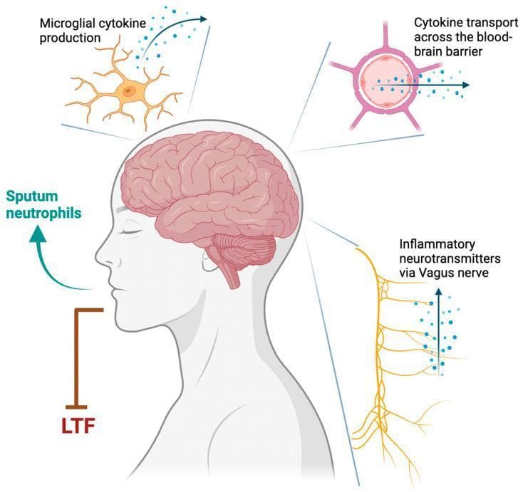 This pathophysiology diagram illustrates the mechanisms by which Type 1 inflammation in asthma may destabilize respiratory control, potentially contributing to obstructive sleep apnea (OSA). A sagittal profile of a human head and neck highlights the brain, brainstem, and central nervous system as the primary regulatory sites. Three key neural-immune pathways are detailed via callouts: 1) Microglial cytokine production, depicting an activated microglial cell with branching processes releasing signaling molecules; 2) Cytokine transport across the blood-brain barrier (BBB), shown as molecules moving from a peripheral blood vessel into the central nervous system parenchyma; and 3) Inflammatory neurotransmitters via the Vagus nerve, represented by an ascending neural pathway from the lungs/airways carrying afferent signals. Additional elements include 'Sputum neutrophils' indicating airway inflammation and 'LTF' (Long-Term Facilitation), representing a compensatory mechanism for respiratory stability that becomes compromised. The diagram serves as an educational tool for pulmonologists and neurologists to understand the neuro-inflammatory cross-talk involving central chemoreceptors and peripheral lung injury.