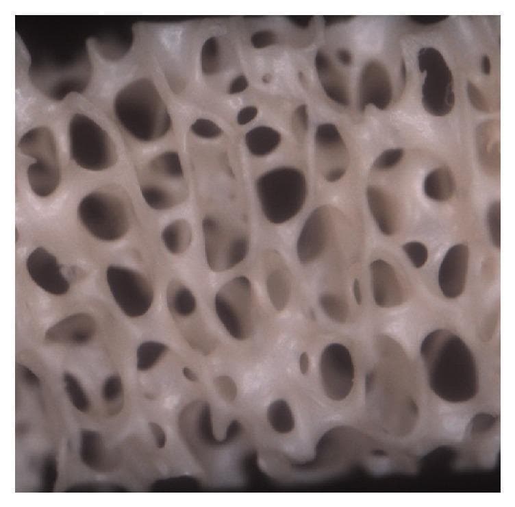 This clinical imaging specimen shows a high-magnification view (40x) of trabecular bone architecture. The image displays a complex, interconnected framework of dense bone trabeculae forming a porous, lattice-like structure. These trabeculae delimit numerous communicating cavities characterized by a variety of ovoid and spherical shapes. The morphology of the bone tissue appears well-preserved, exhibiting a uniform surface texture and a defined spatial arrangement. This visual is significant in orthopedics and histology for demonstrating the natural micro-architecture of cancellous (spongy) bone, illustrating the relationship between dense structural supports and the marrow-containing cavities they define. The specimen represents an experimental group focusing on bone health, regeneration, or collagen distribution, providing a reference for normal versus pathological bone density and structure.
