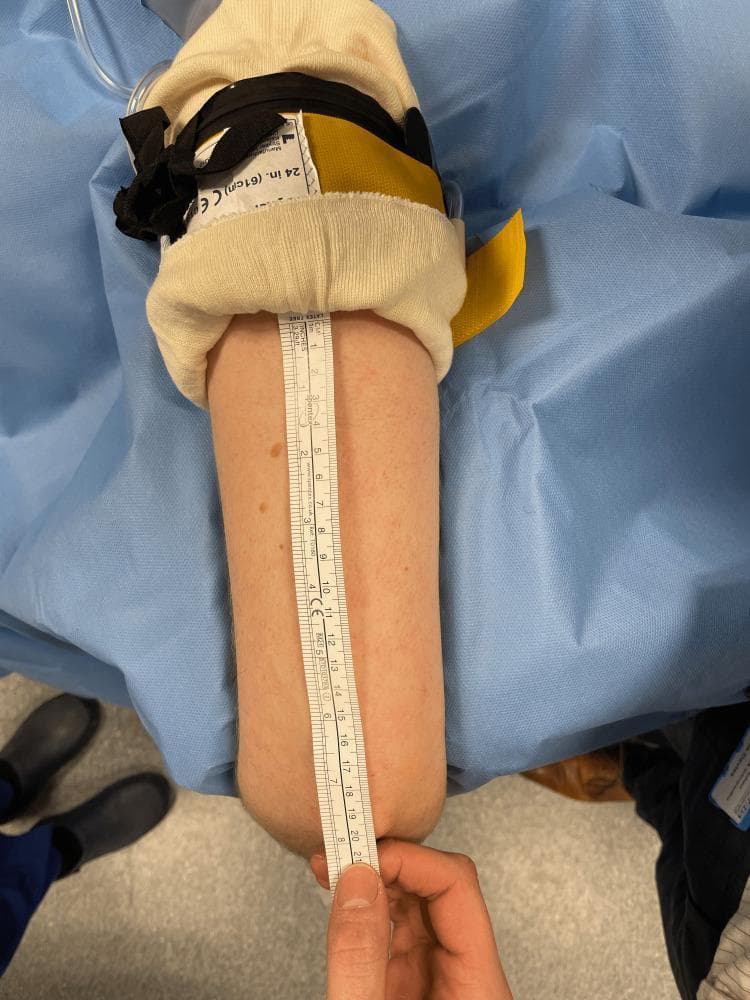 A clinical procedural photograph demonstrating the measurement of a surgical field on a human upper limb. The arm is positioned on a sterile light-blue surgical drape. At the proximal end, a Sterile Standard Tourniquet (SST) is applied over cream-colored protective padding. The pneumatic tourniquet features a black constricting band, black securing straps, a yellow fabric component, and a visible label marked '24 in. (61cm) CE'. A white rigid medical ruler is placed vertically along the posterior aspect of the arm to measure the distance from the distal edge of the sterile tourniquet to the tip of the olecranon (elbow). The ruler shows measurements in both centimeters and inches, indicating a usable surgical field length of approximately 20 cm. This image illustrates perioperative protocols for determining available sterile surgical space when using sterile pneumatic tourniquet systems in orthopedic surgery.