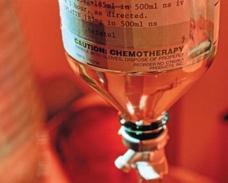 A close-up clinical photograph of a medical intravenous (IV) infusion bag and drip chamber containing a clear, amber-tinted fluid. The setup illustrates clinical oncology practices and chemotherapy administration. The IV bag features a highly visible warning label that reads 'CAUTION: CHEMOTHERAPY. HANDLE WITH GLOVES, DISPOSE OF PROPERLY,' highlighting critical safety protocols for handling cytotoxic agents. Hand-written and printed text on the bag specifies the medication as 'PLATIN 185mg in 500ml ns iv' (normal saline) and provides administration instructions to infuse over '1 hour, as directed.' This image serves as an educational tool for identifying chemotherapy drug preparations, medication labeling standards in a hospital pharmacy, and the necessary precautions taken to prevent healthcare provider exposure to hazardous pharmaceutical substances.