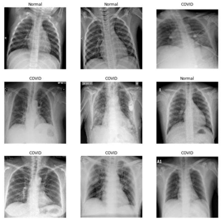 A comparison grid of nine chest X-ray (CXR) images in the posterior-anterior (PA) or anterior-posterior (AP) view, categorized into 'Normal' and 'COVID' groups for medical educational purposes. The images labeled 'Normal' demonstrate healthy pulmonary anatomy, characterized by clear lung fields, sharp costophrenic angles, and well-defined diaphragmatic borders. In contrast, the 'COVID' images illustrate various stages of COVID-19 pneumonia. Key visible findings in the COVID-positive cases include bilateral and unilateral ground-glass opacities (GGOs), peripheral patchy consolidations, and increased interstitial markings indicating pulmonary inflammation. Some clinical images show advanced pathology with diffuse lung involvement, while others exhibit medical equipment such as electrocardiogram leads or cardiovascular devices. This comparative layout is designed to help students and clinicians distinguish between normal thoracic structures and the characteristic radiologic manifestations of viral pneumonia, specifically focusing on the distribution and density of pulmonary infiltrates.
