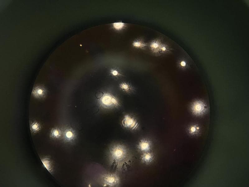 This diagnostic micrograph shows Cryptococcus neoformans in a cerebrospinal fluid (CSF) specimen using an India ink preparation at 400x magnification. The image displays classic negative staining where the dark carbon particles of the ink are excluded by the thick polysaccharide capsules of the yeast. This creates a highly characteristic 'halo' or clear zone surrounding the individual round-to-oval fungal cells against a dark, opaque background. Several yeast cells demonstrate size variation and internal morphology, including central dark cores or concentric ring-like structures. This visual finding is pathognomonic for cryptococcal meningitis in the appropriate clinical context, demonstrating the encapsulated nature of the fungal spores. The distribution pattern shows scattered individual cells and occasional budding forms, which are essential for identifying the yeast’s reproductive activity. This imaging modality is a critical rapid diagnostic tool in medical microbiology for identifying fungal infections in immunocompromised patients.