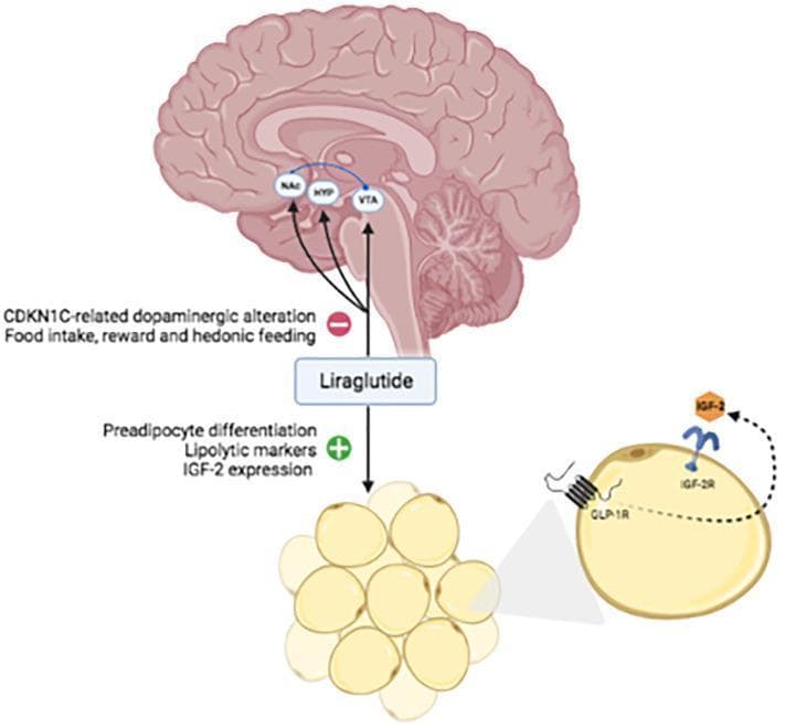 This pathophysiology diagram illustrates the hypothetical central and peripheral mechanisms of Liraglutide, a GLP-1 receptor agonist, in the context of Beckwith-Wiedemann Syndrome (BWS). The upper section shows a sagittal anatomical diagram of the human brain, highlighting the mesolimbic and homeostatic pathways involving the Nucleus Accumbens (NAc), Hypothalamus (HYP), and Ventral Tegmental Area (VTA), interconnected by blue neural pathways. Arrows from Liraglutide point to these regions, indicating a regulatory effect on food intake, reward, and hedonic feeding, potentially counteracting CDKN1C-related dopaminergic alterations. The lower section depicts the peripheral effect on adipose tissue. Liraglutide is shown stimulating a cluster of adipocytes, with positive signs (+) associated with preadipocyte differentiation, lipolytic markers, and IGF-2 expression. A detailed inset shows a single adipocyte expressing GLP-1R and IGF-2R receptors on its membrane, with IGF-2 acting as an extracellular ligand. This educational graphic demonstrates the drug's multi-organ approach to managing obesity by modulating central appetite signaling and peripheral lipid metabolism.