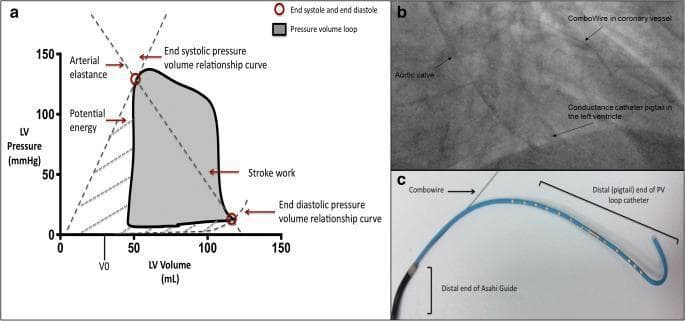 A multi-panel figure illustrating invasive cardiac hemodynamic assessment. Panel (a) is a cardiovascular physiology graph showing a left ventricular (LV) pressure-volume loop. The y-axis represents LV pressure (mmHg) and the x-axis represents LV volume (mL). Key metrics are labeled: the shaded interior represents stroke work (SW); the slopes of the dashed lines define the end-systolic pressure-volume relationship (ESPVR), reflecting contractility, and the end-diastolic pressure-volume relationship (EDPVR), reflecting compliance. Panel (b) is an in-vivo fluoroscopic image in a posteroanterior (PA) view, demonstrating real-time simultaneous data acquisition. It shows a Combowire positioned within a coronary vessel and a conductance catheter (CC) pigtail at the LV apex, with the aortic valve serving as a landmark. Panel (c) provides an ex-vivo photograph of the specialized instrumentation, including the distal end of an Asahi sheathless guide, the Combowire, and the pigtail conductance catheter used for LV pressure-volume analysis. The figure serves to demonstrate the methodology for gold-standard clinical research into cardiac-coronary interactions and hemodynamics.