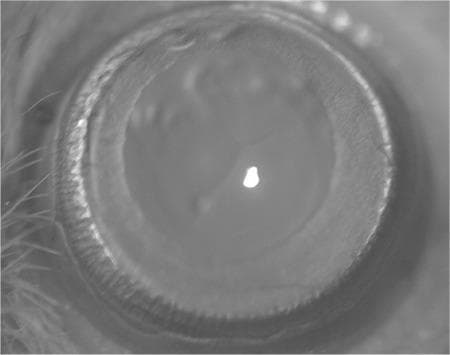 This monochrome clinical photograph, captured via slit-lamp microscopy at 25x magnification, illustrates a Stage 1 cataract. The image focuses on the anterior segment of the eye, showcasing the lens through a dilated pupil. Morphologically, the lens demonstrates initial pathological changes, specifically characterized by a subtle cloudiness or haziness in the posterior subcapsular region and minimal nuclear opacity. The anterior aspect of the lens remains relatively clear. Surrounding the crystalline lens, the iris is visible with a distinct circular border and textured surface. Peripheral eyelashes are partially visible at the left margin. This image serves as an educational reference for early-stage cataract classification, demonstrating the subtle loss of lens transparency and the specific anatomical localization of early opacification typical in sodium selenite-induced models, relevant for ophthalmology and toxicology research.