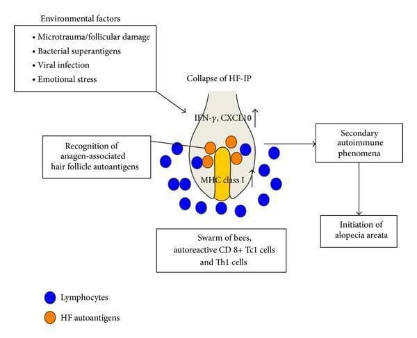 This pathophysiology diagram illustrates the development of alopecia areata (AA) through a multi-step autoimmune process. The central anatomical focus is an anagen-phase hair follicle (HF) bulb. A flow diagram depicts 'Environmental factors' (e.g., viral infection, stress, microtrauma) triggering the 'Collapse of HF-immune privilege (IP)'. This leads to increased expression of IFN-γ and CXCL10, as well as MHC class I within the dermal papilla/matrix area (yellow region). Visually, blue circles (representing autoreactive CD8+ Tc1 and Th1 cells) accumulate around the follicle base in a 'swarm of bees' pattern. These lymphocytes recognize anagen-associated HF autoantigens (orange circles). The resulting secondary autoimmune phenomena culminate in the final box labeled 'Initiation of alopecia areata'. The diagram serves as an educational tool for dermatology students to understand how the loss of hair follicle immune privilege and subsequent T-cell infiltration drive inflammatory non-scarring hair loss.