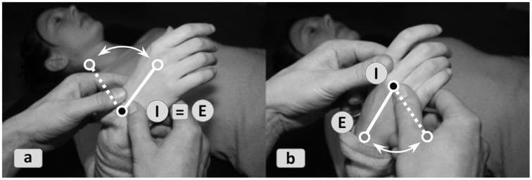 This comparative clinical photograph and educational diagram demonstrates two different manual therapy approaches to wrist joint mobilization: local versus remote cueing. Frame (a) illustrates local mobilization where the practitioner's hands are positioned directly at the wrist joint. Geometrically, this is represented by the formula 'I ≡ E', signifying that the interface (I) and the effector space (E) are identical; the force is applied exactly where the therapeutic movement is intended to occur. Frame (b) depicts remote mobilization utilizing the Feldenkrais Method principle of 'proximal-distal-reversal'. Here, the practitioner manipulates the base joints of the fingers (effector space, E) to induce a change in the organization of the wrist (interface, I). The diagrams use solid and dashed lines with curved arrows to indicate the lever arms and the direction of oscillatory or rotational force applied. This visual aid teaches how different actuation pathways can be used to address the same anatomical joint eigenfunction, allowing for subtle variations in neuromuscular feedback and musculoskeletal organization.