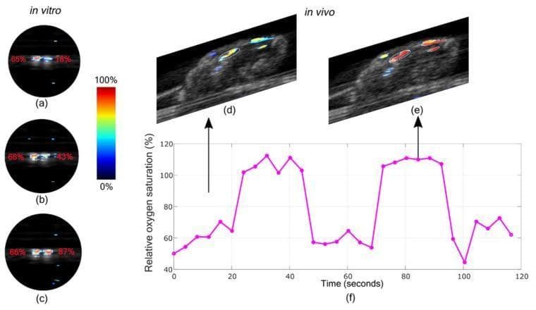 This composite educational graphic illustrates the capabilities of photoacoustic imaging (PAI) and ultrasound (US) for monitoring oxygen saturation (sO2). Panels (a–c) present in-vitro oxygen saturation maps of two tubes. The left tube serves as a control with stable blood oxygenation (~65-66%), while the right tube demonstrates a progressive increase in sO2 from 18% to 43% and 87%, represented by a color gradient shifting from blue (low) to red (high). Panels (d) and (e) display in-vivo interleaved PA/US images of a mouse thigh muscle. These images show the dynamic change in hemoglobin oxygenation within the tissue during different phases of an oxygen-controlled breathing cycle. Panel (f) provides a corresponding line graph plotting relative oxygen saturation (%) over 120 seconds, showing distinct peaks (~110%) and troughs (~60%) that correlate with the high and low oxygen cycles observed in the visual mapping. This content demonstrates the clinical relevance of multispectral LED-based PAI in non-invasively quantifying tissue hypoxia and vascular functional parameters.