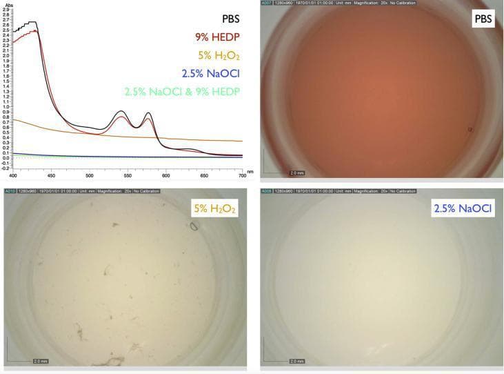 This composite educational graphic illustrates the interaction between human whole blood and various endodontic irrigants through spectrophotometry and microscopy. The top-left panel displays an absorption spectrum (400–700 nm). Mixtures of blood with PBS and 9% HEDP show characteristic double peaks for oxygenated hemoglobin at approximately 542 nm and 578 nm, indicating the preservation of the heme iron's oxygen-binding state. In contrast, these peaks are absent in the 5% H2O2 mixture, and the 2.5% NaOCl (with or without HEDP) curves are flat, indicating total clearing of blood constituents. The remaining panels show microscopy images of the mixtures: the PBS control (top right) retains a deep red color; the 5% H2O2 mixture (bottom left) exhibits a bleaching effect but contains visible denatured protein agglomerates; and the 2.5% NaOCl mixture (bottom right) shows complete dissolution of all blood components. This comparison demonstrates the potent tissue-dissolving and deproteinizing capacity of sodium hypochlorite compared to hydrogen peroxide and HEDP in a dental clinical context.
