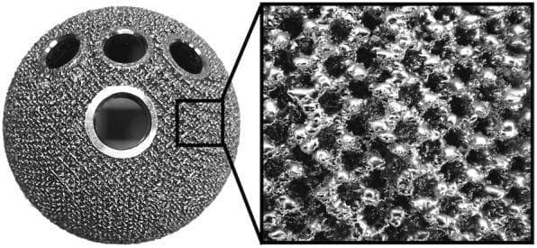 This orthopaedic clinical photograph displays the SQRUM TT acetabular socket, a prosthetic component used in Total Hip Arthroplasty (THA). The implant is made from a titanium alloy (Ti6Al4V) and exhibits a spherical shape with a specialized tridimensional, multiplane porous structure created via electron beam melting. The left portion of the image shows the macroscopic view of the hemispherical cup, featuring one central large circular opening and four smaller peripheral openings for screw fixation. The right portion provides a high-magnification inset of the surface, revealing a repeating hexagonal lattice with a porosity of 60% and a pore size of 640 μm. This textured, interconnected framework is designed to mimic natural cancellous bone, facilitating biological secondary fixation through bone ingrowth. The surface morphology appears rough and granular, optimized to provide initial stability and long-term osteointegration in patients with hip conditions such as osteonecrosis or osteoarthritis.
