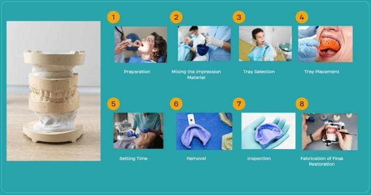 This infographic illustrates the eight clinical and laboratory steps of the traditional dental impression and restoration process. A primary vertical image shows a completed gypsum plaster model (stone cast) of human dentition mounted for articulation. The procedural sequence is divided into numbered panels: 1) Clinical preparation of the patient; 2) Manual mixing of impression material (e.g., alginate or polyvinyl siloxane) in a rubber bowl; 3) Selection of an appropriate maxillary/mandibular arch tray; 4) Intraoral tray placement and seating; 5) Setting time during which the material undergoes polymerization or gelation; 6) Removal of the set impression from the oral cavity; 7) Inspection for clinical accuracy, voids, or tears; and 8) Fabrication of the final restoration, showing a technician using an articulator and dental ceramics. The visual provides a comprehensive overview of prosthodontic workflows, emphasizing the transition from clinical chairside procedures to dental laboratory fabrication.