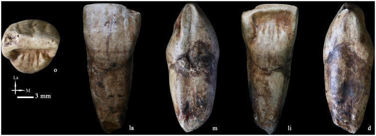 A clinical specimen image showing multiple views of a high-quality replica of a right upper central incisor (PA835). The tooth is displayed from five different anatomical perspectives: occlusal (o), labial (la), mesial (m), lingual (li), and distal (d). The occlusal view illustrates the biting surface morphology with visible ridges and grooves. The lingual aspect highlights a prominent basal eminence and several finger-like vertical projections near the incisal edge. The labial surface demonstrates a distinctive wrinkled texture with longitudinal ridges, sometimes associated with primitive cingulum-like structures. Both the crown and root portions show complex surface characteristics including beige-to-brown staining and textural variations. The root is robust, maintaining its breadth significantly before narrowing towards the apex. This specimen is used in dental anthropology and clinical education to study morphological variations in human dentition, specifically comparing modern and paleoanthropological features such as shovel-shaping and surface crenulation. A 3 mm scale bar is provided for reference.