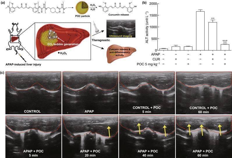 This composite educational graphic illustrates the use of poly(oxalate-co-curcumin) (POC) particles as theranostic agents for acetaminophen (APAP)-induced acute liver failure (ALF) in a murine model. Panel (a) contains a pathophysiology diagram showing the synthesis of POC particles and their mechanism: in the presence of hydrogen peroxide (H2O2) within the injured liver, POC particles undergo an H2O2-responsive degradation to release curcumin (anti-inflammatory) and generate CO2 bubbles (ultrasound contrast). Panel (b) is a bar chart comparing serum alanine aminotransferase (ALT) levels across groups, demonstrating that POC particles significantly reduce hepatic enzymes compared to APAP-only or free curcumin (CUR) treatments. Panel (c) presents longitudinal diagnostic ultrasound images of mouse livers. The liver contours are outlined in red. In the APAP + POC group, there is a progressive increase in echogenicity (bright signals indicated by yellow arrows) from 5 to 60 minutes post-treatment, representing real-time monitoring of ROS-triggered CO2 bubble generation, while control and APAP-only groups remain hypoechoic.
