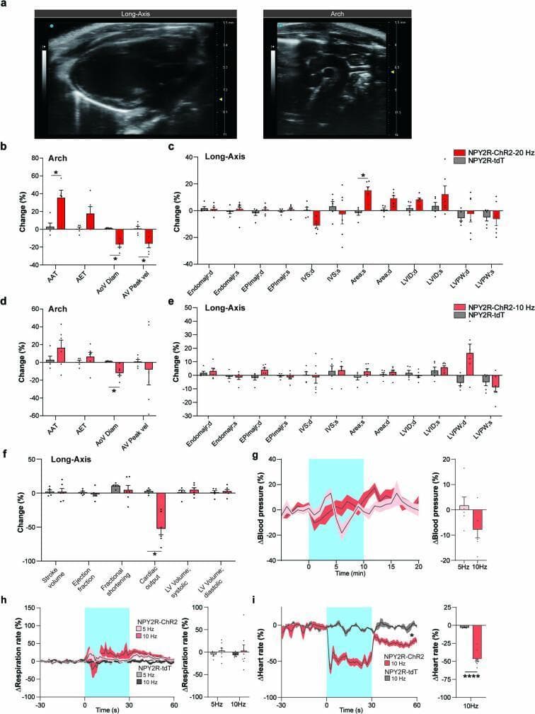 This composite educational infographic illustrates the physiological characterization of vagal sensory neurons (NPY2R VSNs) in response to optogenetic photostimulation, particularly focusing on mechanisms of syncope. Panel a shows representative B-mode ultrasound diagnostic images of a mammalian heart in the parasternal long-axis view and the aortic arch. Panels b through f present comparison bar charts showing the percentage change in various cardiovascular parameters after 20 Hz and 10 Hz photostimulation. Specifically, panel b demonstrates that 20 Hz stimulation significantly decreases aortic valve diameter (AoV Diam) and peak blood velocity (AV Peak vel) while increasing aortic acceleration time (AAT). Panel c reveals an increase in the left ventricular end-systolic area (Area;s). Panel f indicates a significant drop in cardiac output. Panels g, h, and i provide time-course line graphs and summary bar charts demonstrating time-locked reductions in blood pressure, respiration rate, and heart rate during photostimulation. The data collectively illustrate the physiological triad of the Bezold-Jarisch reflex (BJR) and its relevance to syncope research.