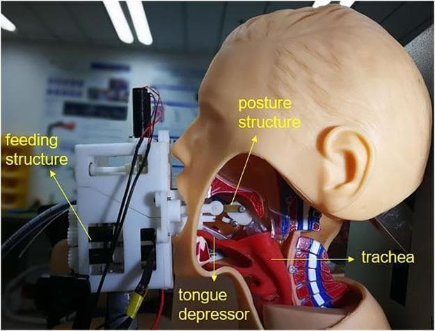 This clinical photograph/diagram shows a lateral cross-section of a medical manikin used to demonstrate a robotic-assisted intubation system. The image illustrates the mechanical interface between the 'Remote Robot-Assisted Intubation System' (RRAIS) and human upper airway anatomy. Key visible components include an external feeding structure situated at the mouth, which houses the mechanism for advancing the endotracheal tube. A robotic tongue depressor is shown inserted into the oral cavity, making contact with the base of the tongue to facilitate glottis exposure. Internally, a 'posture structure' is positioned within the oropharynx to control the tube's tip orientation. Anatomical landmarks labeled on the manikin's sagittal view include the tongue, oral cavity, and the trachea, demonstrating the intended pathway for the airway device. This visual serves as an educational tool for anesthesiology and emergency medicine, highlighting technological advancements in airway management and the mechanics of remote-controlled endotracheal intubation.