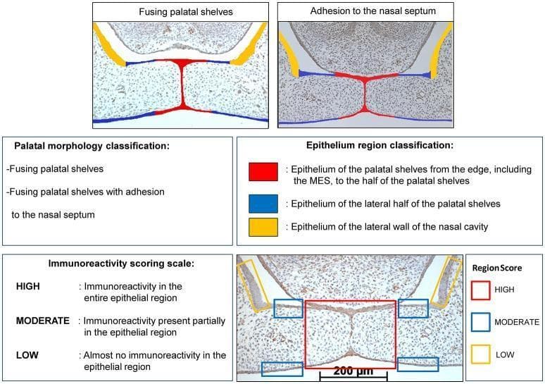 Educational diagram and histological composite illustrating palatal morphology classification and immunoreactivity scoring during palatogenesis. The upper panels show two histological stages: 'Fusing palatal shelves' and 'Fusing palatal shelves with adhesion to the nasal septum.' A color-coded epithelium region classification system is applied: RED indicates the epithelium from the midline epithelial seam (MES) to half the shelf width; BLUE identifies the lateral half of the palatal shelves; and YELLOW highlights the lateral wall of the nasal cavity as a control region. The lower section provides a semi-quantitative 'Immunoreactivity scoring scale' (HIGH, MODERATE, LOW) based on the distribution of staining (e.g., CXCL11, CXCR3, or HO-1) within these specific regions of interest. A representative immunostained section at E15 demonstrates high reactivity in the RED midline region, moderate in BLUE lateral regions, and low in the YELLOW nasal cavity control. This resource is designed for understanding embryonic craniofacial development and the biochemical signaling involved in secondary palate fusion.