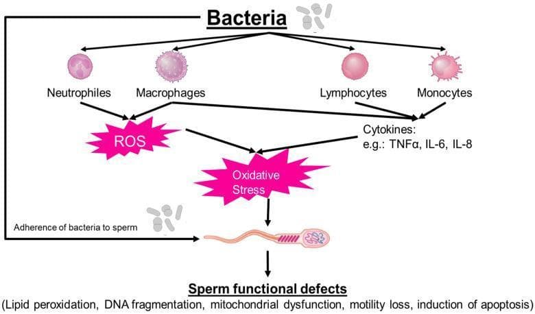 A pathophysiology diagram illustrating the direct and indirect mechanisms by which bacteria cause sperm functional defects and male infertility. The diagram outlines two primary pathways: 1) Direct Interaction: Adherence of bacteria to the sperm surface. 2) Indirect Inflammatory Response: Bacterial presence triggers immune cell activation, specifically involving neutrophils, macrophages, lymphocytes, and monocytes. These leukocytes release reactive oxygen species (ROS) and pro-inflammatory cytokines, including TNF-α, IL-6, and IL-8. Both pathways converge to induce cellular oxidative stress. The final section of the flowchart lists the resulting sperm functional defects, which include lipid peroxidation, DNA fragmentation, mitochondrial dysfunction, loss of motility, and the induction of apoptosis. This educational visual provides a comprehensive overview of how bacterial infections and the subsequent leukocytospermic response impair reproductive health at the cellular level.
