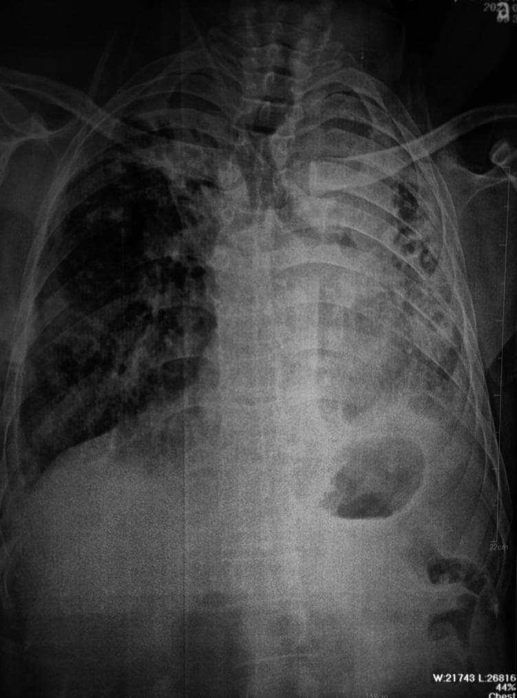 Hugging Face pmc clinical VQA raw