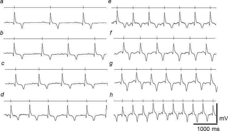 This diagnostic image displays eight comparative electrocardiogram (ECG) rhythm strips, labeled (a) through (h), demonstrating the physiological accommodation of the ECG waveform to an increasing heart rate. The sequences transition from a low heart rate in trace (a) (40–45 bpm) to a high heart rate in trace (h) (140–145 bpm). Each rhythm strip includes a horizontal timing line with vertical markers above the trace that denote successive R-wave occurrences, visually representing the shortening of the R-R interval and basic cycle length (BCL). Key educational features shown include the consistent morphology and amplitude of the PQRST complexes despite the rate increase, and the progressive compaction of the T-Q (diastolic) interval. The traces illustrate the equine cardiac conduction system's ability to maintain stable ventricular depolarization (QRS) and recovery (QT) properties across a broad physiological range. Scale markers at the bottom right indicate voltage in millivolts (mV) and time in milliseconds (1000 ms).