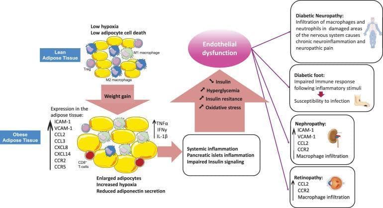 A pathophysiology diagram illustrating the progression from obesity-induced adipose tissue inflammation to Type 2 Diabetes Mellitus (T2DM) and its vascular complications. The visual compares 'Lean Adipose Tissue'—characterized by small adipocytes, low hypoxia, and anti-inflammatory M2 macrophages and Regulatory T-cells (Tregs)—with 'Obese Adipose Tissue' following weight gain. The obese state shows hypertrophied (enlarged) adipocytes, increased hypoxia, and a shift toward a pro-inflammatory environment featuring M1 macrophages, CD8+ T-cells, and elevated expression of cytokines (TNFα, IFNγ, IL-1β), chemokines (CCL2, CXCL8), and adhesion molecules (ICAM-1, VCAM-1). A central pathway illustrates how this local inflammation leads to systemic inflammation, pancreatic islet dysfunction, and impaired insulin signaling. This results in a cascade of hyperglycemia, oxidative stress, and insulin resistance, culminating in endothelial dysfunction. The right side of the diagram maps these physiological changes to specific clinical complications: Diabetic Neuropathy (macrophage/neutrophil infiltration), Diabetic Foot (impaired immune response), Nephropathy (macrophage infiltration and increased CCR2/CCL2), and Retinopathy. The illustration serves as an educational tool for understanding the immunometabolic drivers of chronic diabetic vascular damage.