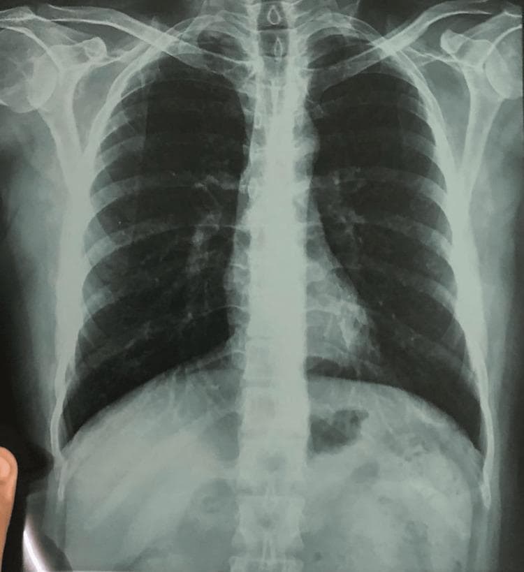 Hugging Face pmc clinical VQA raw