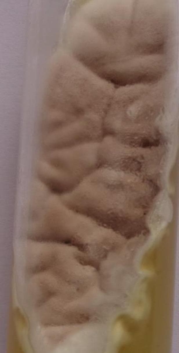 A diagnostic microbiology image showing a fungal culture on an agar slant, specifically Sabouraud Dextrose Agar (SDA). The image illustrates the macroscopic morphology of Purpureocillium lilacinum, characterized by its distinctive lilac-to-pinkish coloration. The colonies are flat and exhibit a densely floccose, velvety texture across the surface of the medium. There is evidence of confluent growth spreading along the slant, with the reverse side (visible at the periphery) appearing off-white to pale yellow. This visual demonstration is critical for identifying hyphomycetes in clinical specimens, particularly in immunocompromised patients presenting with deep-seated mycoses or skin and soft tissue infections. The image highlights the typical maturation and pigmentation used by microbiologists to differentiate this opportunistic pathogen from other filamentous fungi.