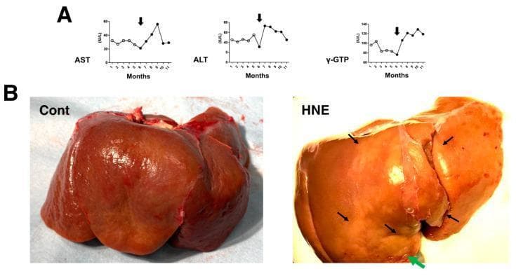 This composite educational image illustrates hepatic injury markers and gross pathological changes following chronic exposure to hydroxynonenal (HNE). Section A contains three temporal line plots showing serum levels of AST, ALT, and γ-GTP measured over 11 months. Open circles represent baseline levels, while closed circles following the black arrow indicate elevated enzyme levels after the initiation of HNE injections, signifying hepatotoxicity. Section B presents a side-by-side comparison of liver autopsy specimens. The control specimen (Cont) shows a normal, uniform reddish-brown surface. In contrast, the HNE-treated liver (HNE) demonstrates marked architectural and color changes, characterized by heterogeneous, whitish-yellow discolored regions (indicated by black and green arrows) intermingled with dark-brown areas. These macroscopic findings correspond to severe hepatocyte degeneration and lipid accumulation. This visual resource is intended for medical education regarding chemical-induced liver injury, non-alcoholic fatty liver disease (NAFLD) models, and the correlation between biochemical biomarkers and gross clinical pathology.