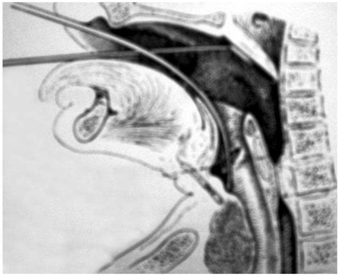 Hugging Face pmc clinical VQA raw