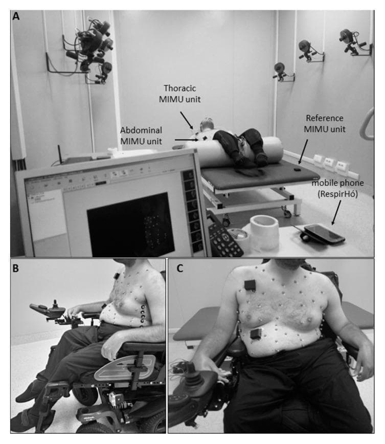 Clinical and procedural photographs illustrating a research setup for respiratory monitoring using wearable inertial sensors and Optoelectronic Plethysmography (OEP). Panel A shows a subject in the supine position on an elevated examination table within a laboratory equipped with wall-mounted infrared cameras. The setup identifies Thoracic and Abdominal Magnetic Inertial Measurement Units (MIMU) placed on the subject's trunk, a Reference MIMU on the table, a monitoring smartphone ('RespirHó'), and a data display monitor. Panels B (lateral view) and C (frontal view) depict a male subject seated in a power wheelchair. The subject's torso is shirtless, revealing multiple small, spherical retro-reflective markers and rectangular MIMU sensors adhered to the chest and abdominal wall. This clinical setup is designed to evaluate chest wall movement and breathing patterns in static conditions (supine vs. seated), often used in the context of neuromuscular disease monitoring to validate wearable sensor accuracy against the OEP gold standard.