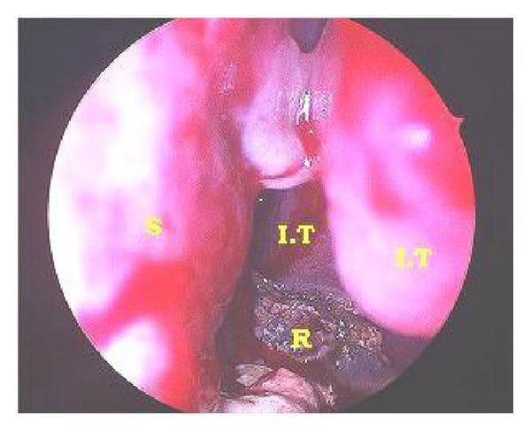 Hugging Face pmc clinical VQA raw