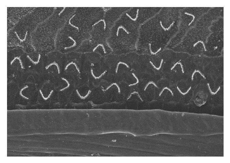 High-magnification scanning electron micrograph (SEM) showing a surface view of hair cell stereocilia bundles within the mammalian organ of Corti. The image illustrates a state of marked architectural disorganization, where numerous V-shaped stereocilia bundles appear randomly oriented and irregularly spaced across the reticular lamina. This pathological or experimental arrangement contrasts with the highly ordered, uniform rows (typically one row of inner hair cells and three rows of outer hair cells) seen in healthy cochlear tissue. The disorganized bundles are situated over regions that would typically be occupied by supporting cells, suggesting incomplete integration or ectopic differentiation following stem-cell-based regenerative therapy. The underlying cellular surface appears relatively smooth with poorly defined cell boundaries. This visual demonstrates key challenges in sensory hair cell regeneration, specifically the difficulty in achieving precise planar cell polarity and anatomical alignment required for functional mechanotransduction.