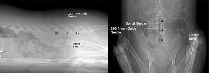 Diagnostic CT scout images (sagittal and dorsal views) demonstrating the procedural localization for a lumbar puncture in a porcine model. The sagittal view (left) shows a 22-gauge, 1-inch guide needle inserted as a radiopaque cutaneous marker. Its placement is localized dorsally between the L3 and L4 lumbar vertebrae, utilizing the cranial border of the flexed stifle as a palpable anatomical landmark. The dorsal view (right) displays the final positioning of the larger spinal needle in relation to the guide needle. Both needles are visible as linear radiopaque densities along the dorsal midline. The spinal needle is positioned cranially to the guide needle, precisely targeting the L3-L4 intervertebral space for subarachnoid access. These views are essential for confirming the longitudinal and midline trajectory before advancing the needle to the floor of the vertebral canal for myelographic contrast injection. Key anatomical landmarks labeled include the L3, L4, and L5 vertebrae and the flexed stifle joint.
