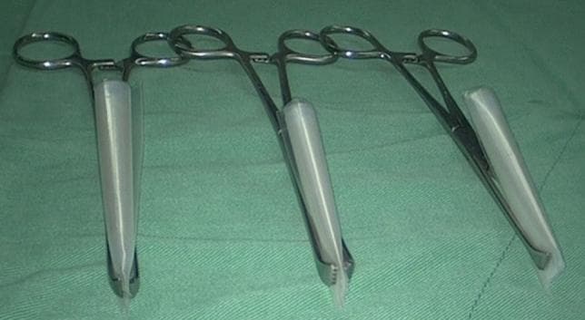 This clinical photograph demonstrates a specific intraoperative preparation technique for Seprafilm, a bioresorbable adhesion barrier used in abdominal and pelvic surgery. The image shows three individual Allis tissue forceps, each securely gripping a tube-shaped roll. Each roll consists of a segment of Seprafilm placed within a sterile, clear plastic sleeve and rolled tightly to facilitate laparoscopic delivery. The Allis forceps are positioned with their interlocking teeth at the distal end of the rolls to maintain the cylindrical shape and allow for controlled insertion through a surgical port or small incision site. This visual serves as a procedural guide for surgical staff in preparing surgical materials to prevent postoperative adhesions. The instruments and prepared rolls are displayed on a standard green sterile surgical drape, indicating a sterile operating room environment.
