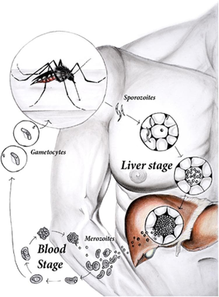 A medical illustration of the Plasmodium parasite lifecycle (Malaria) overlaying a human torso. The diagram details the vector-to-host transmission and the subsequent biological stages. It starts with an Anopheles mosquito vector introducing elongated sporozoites into the skin. The 'Liver stage' illustrates sporozoites entering hepatocytes, maturing into large schizonts filled with merozoites, and the subsequent rupture of liver cells. The 'Blood stage' depicts the erythrocytic cycle, where merozoites infect red blood cells (RBCs), replicate asexually, and cause RBC lysis. Distinctive crescent-shaped gametocytes are shown developing from the blood stage, signifying the potential for transmission back to a mosquito vector during a blood meal. Key educational concepts include the pre-erythrocytic (liver) and erythrocytic (blood) phases of infection, morphological differentiation of the parasite (sporozoite, schizont, merozoite, gametocyte), and the role of the mosquito as a disease vector. The diagram is designed for intermediate medical students to understand the pathogenesis and sequential progression of Malaria.