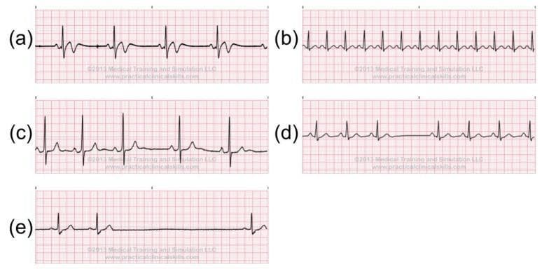 Hugging Face pmc clinical VQA raw