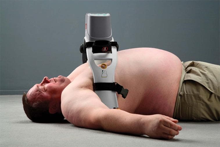 A clinical photograph demonstrating the application of a LUCAS 3 mechanical chest compression system on an adult male in a supine position. The image serves as a procedural demonstration of Active Compression-Decompression Cardiopulmonary Resuscitation (ACD-CPR). The device is positioned centrally over the sternum, featuring a white support arch that spans the torso and is secured with black stabilization straps. The grey upper housing contains the motor and control interface, while a vertical piston with a circular suction cup/pad is visible in contact with the lower third of the sternum to deliver consistent, high-quality chest compressions. The patient is bare-chested to show proper anatomical placement of the device between the axillary lines. This image is used for training medical professionals in emergency medicine and advanced cardiac life support (ACLS) to illustrate mechanical adjuncts that reduce provider fatigue and maintain perfusion during cardiac arrest.