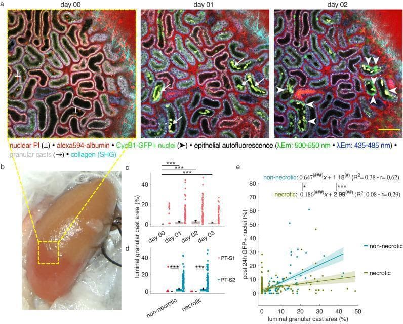 Educational visual summary illustrating the progression of Acute Kidney Injury (AKI) and tubule remodeling using serial in vivo 2-photon microscopy and statistical analysis. Panel (a) presents time-lapse images (Day 00, 01, 02) of a kidney 'Mid' region in CycB1-GFP mice following partial ischemia-reperfusion injury (IRI). The images show epithelial autofluorescence (λEm: 500-550 nm and 435-485 nm) and markers for nuclear necrosis (Propidium Iodide, PI), albumin (Alexa594), and cell cycling (CycB1-GFP+). Key observations include the initial appearance of luminal granular casts (arrows) on Day 1, followed by a substantial increase in proliferating GFP+ nuclei (arrowheads) by Day 2 in downstream tubule segments. Panel (b) shows a clinical photograph of a mouse kidney during arterial occlusion, identifying the ischemic border. Panels (c) and (d) provide volumetric quantification of luminal granular cast area across different days and tubule segments (PT-S1 vs. PT-S2), while panel (e) displays linear regression analysis correlating granular cast accumulation with subsequent epithelial proliferation in non-necrotic and necrotic segments.