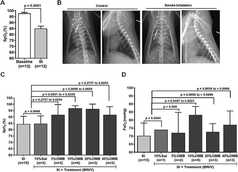 This composite educational image illustrates the physiological and radiological impacts of smoke inhalation (SI) and the therapeutic effects of oxygen microbubbles (OMB). Panel A shows a bar graph demonstrating a significant decrease in peripheral oxygen saturation (SpO2) from a baseline of ~98% to ~85% following smoke inhalation. Panel B presents ventral-dorsal and lateral thoracic x-rays of an animal model. The 'Control' images show clear lung fields and distinct cardiac silhouettes. In contrast, the 'Smoke Inhalation' images demonstrate diffuse, bilateral pulmonary infiltrates and increased lung opacity, characteristic of acute lung injury. Anatomical landmarks including the spine, ribs, and sternum are visible across both views. Panels C and D provide statistical dose-response analyses for SpO2 and partial pressure of arterial oxygen (PaO2). These graphs show that intraperitoneal administration of OMB, particularly at a dose of 10% body weight/volume (BW/V), significantly improves oxygenation compared to saline controls, indicating the potential for OMB to mitigate SI-induced hypoxemia.